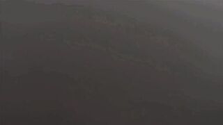 Step Mom vs Sunburn - Kat Marie - MomComesFirst - Alex Adams